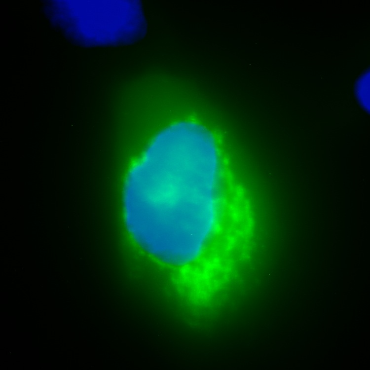 C10orf65 GFP