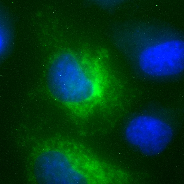 C12orf62 GFP