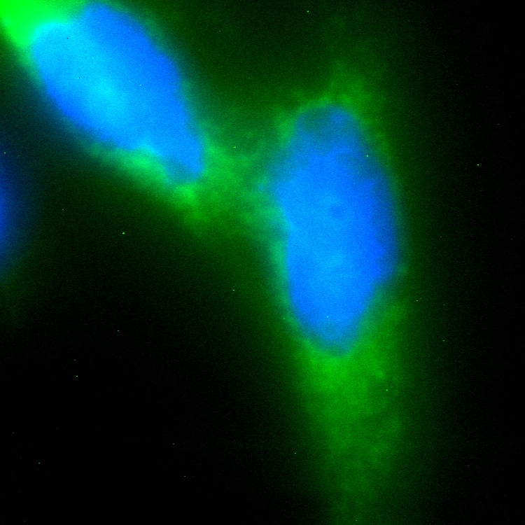 C14orf112 GFP