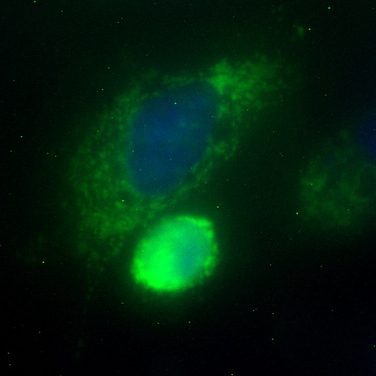 C14orf156 GFP