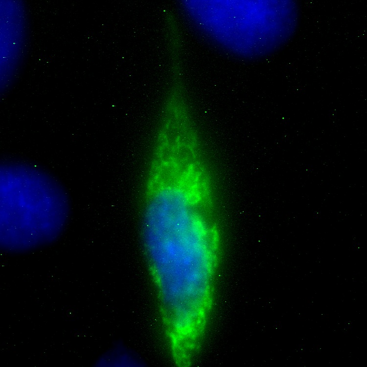 C18orf19 GFP