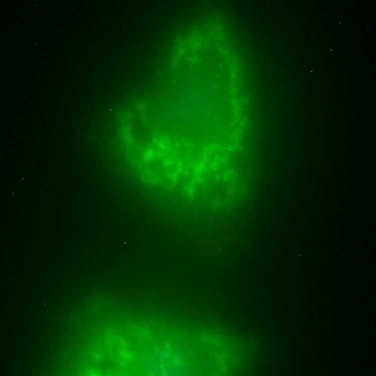 C18orf55 GFP