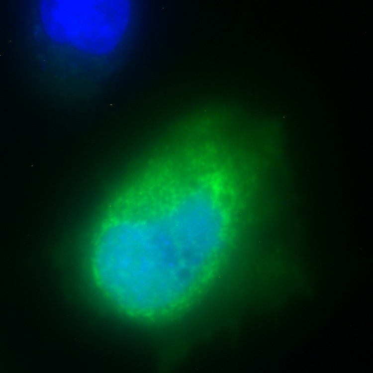 C20orf24 GFP