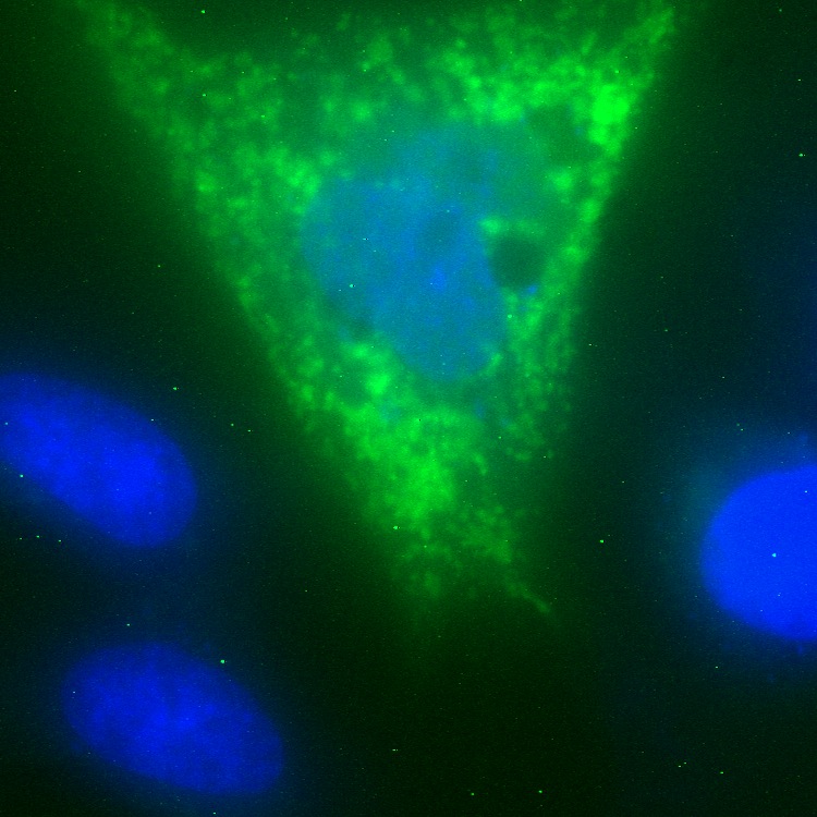 C20orf45 GFP