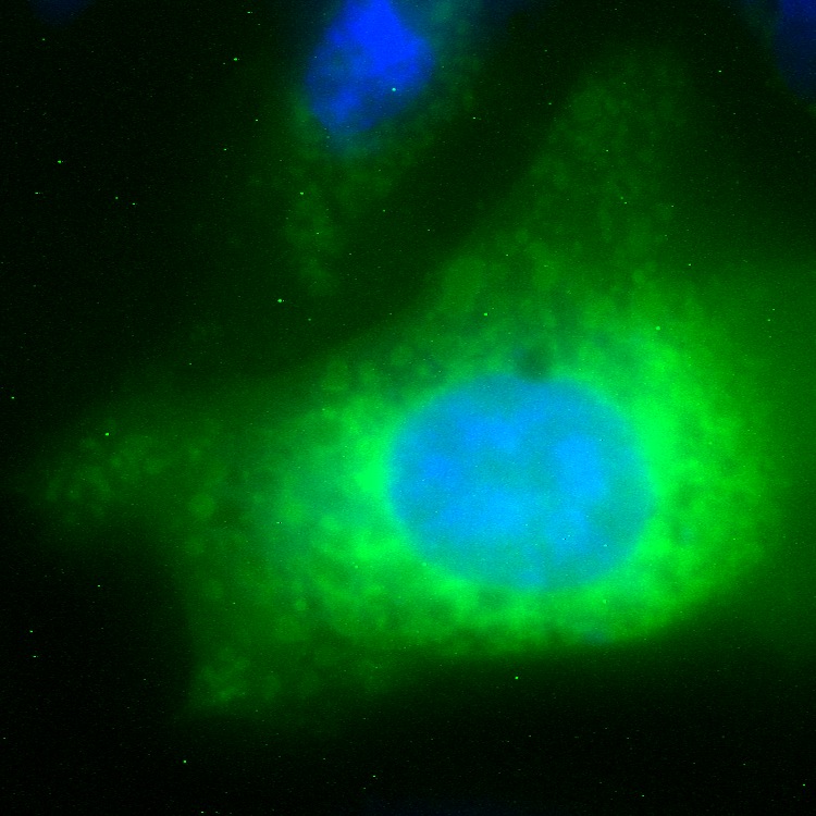 C3orf31 GFP
