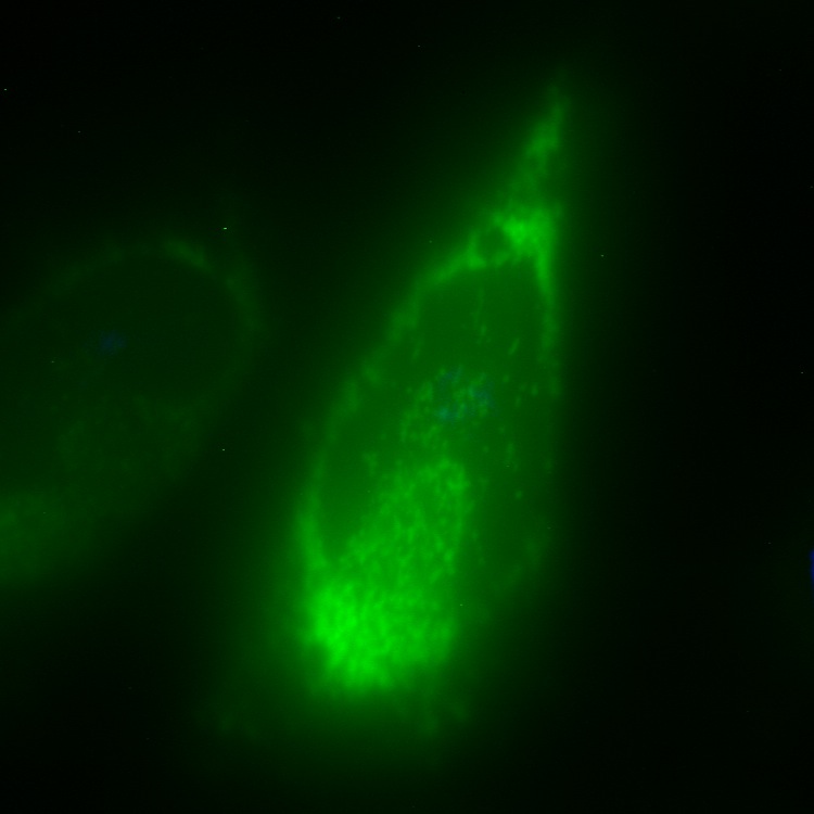 C6orf125 GFP