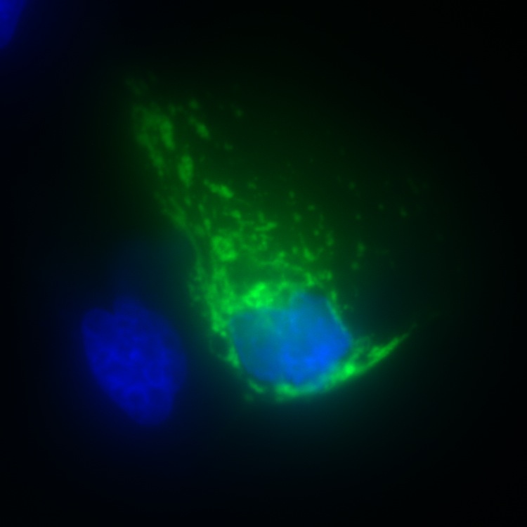 DNAJC11 GFP