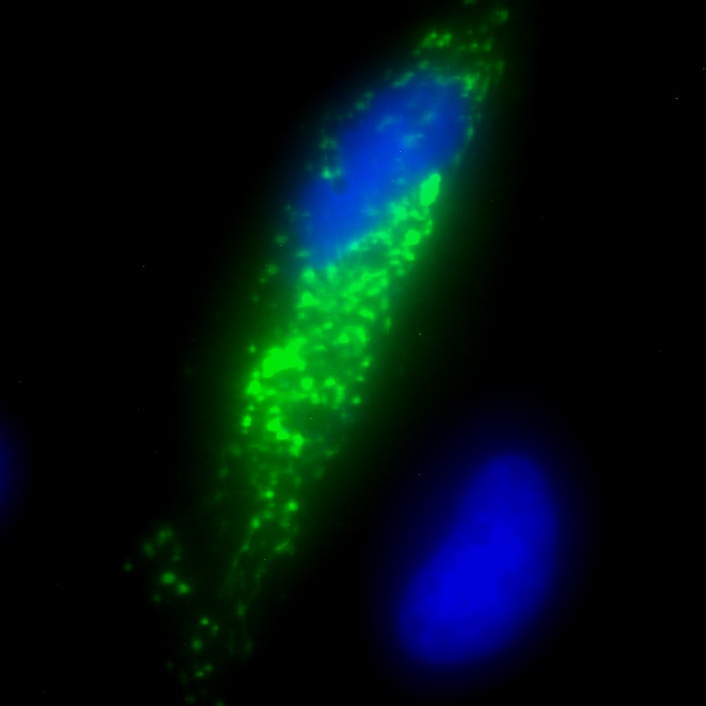DNAJC4 GFP