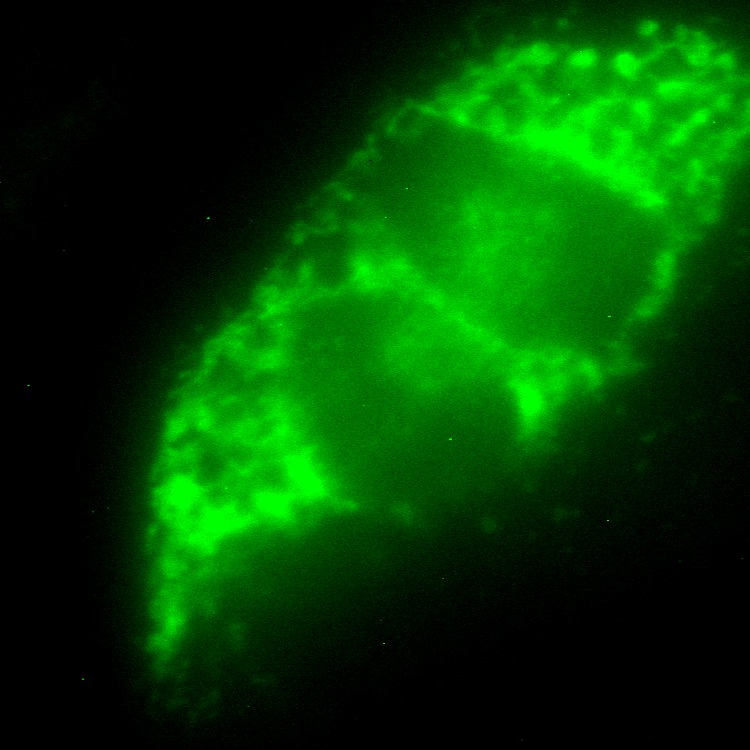 LETMD1 GFP