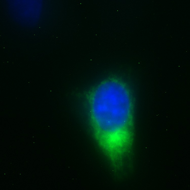 NME3 GFP