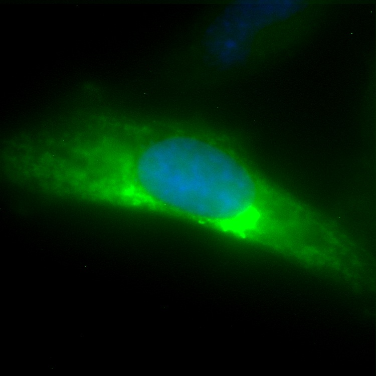 NT5C GFP